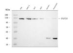 RNF20 Antibody in Western Blot (WB)