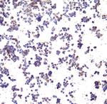 PD-L1 Antibody in Immunocytochemistry (ICC/IF)