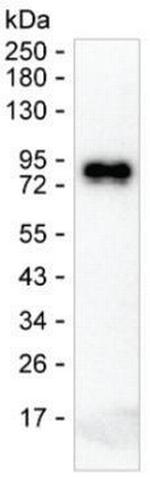 Human IgE Antibody in Western Blot (WB)