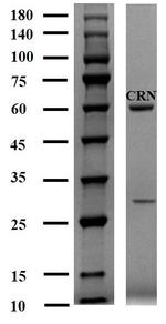 Canrenone Antibody in SDS-PAGE (SDS-PAGE)