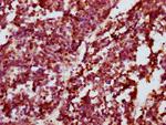 Phospho-CREB (Ser133) Antibody in Immunohistochemistry (Paraffin) (IHC (P))