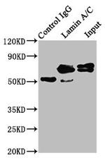 Lamin A Antibody in Immunoprecipitation (IP)