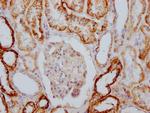 ATP1A1 Antibody in Immunohistochemistry (Paraffin) (IHC (P))