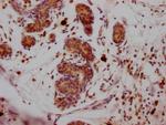 SUZ12 Antibody in Immunohistochemistry (Paraffin) (IHC (P))