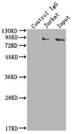 SUZ12 Antibody in Immunoprecipitation (IP)