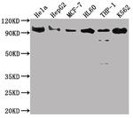 SUZ12 Antibody in Western Blot (WB)