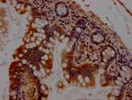 Chk1 Antibody in Immunohistochemistry (Paraffin) (IHC (P))