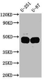 PAI1 Antibody in Western Blot (WB)