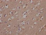 Fyn Antibody in Immunohistochemistry (Paraffin) (IHC (P))