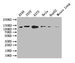 DDR2 Antibody in Western Blot (WB)