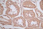 RAN Antibody in Immunohistochemistry (Paraffin) (IHC (P))