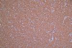 ROBO1 Antibody in Immunohistochemistry (Paraffin) (IHC (P))