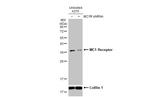 MC1R Antibody in Western Blot (WB)