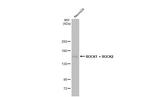 ROCK1/ROCK2 Antibody in Western Blot (WB)