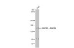 ROCK1/ROCK2 Antibody in Western Blot (WB)