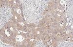 RIP1 Antibody in Immunohistochemistry (Paraffin) (IHC (P))