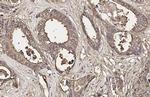 CEA Antibody in Immunohistochemistry (Paraffin) (IHC (P))