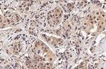 PIN1 Antibody in Immunohistochemistry (Paraffin) (IHC (P))