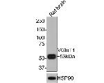 VGLUT1 Antibody in Western Blot (WB)