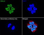 SALL4 Antibody in Immunocytochemistry (ICC/IF)