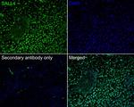 SALL4 Antibody in Immunohistochemistry (Paraffin) (IHC (P))