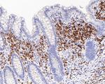 CD79a Antibody in Immunohistochemistry (Paraffin) (IHC (P))