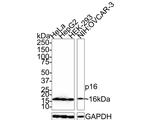 p16INK4a Antibody in Western Blot (WB)