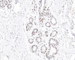 FOXP1 Antibody in Immunohistochemistry (Paraffin) (IHC (P))