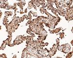 SMAD4 Antibody in Immunohistochemistry (Paraffin) (IHC (P))