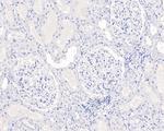 SOX10 Antibody in Immunohistochemistry (Paraffin) (IHC (P))