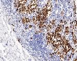 SOX10 Antibody in Immunohistochemistry (Paraffin) (IHC (P))