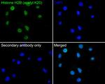 H2BK20ac Antibody in Immunocytochemistry (ICC/IF)