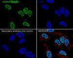 JMJD2B Antibody in Immunocytochemistry (ICC/IF)