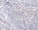 JMJD2B Antibody in Immunohistochemistry (Paraffin) (IHC (P))