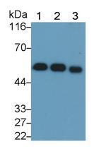 GC Antibody in Western Blot (WB)