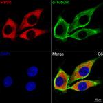 S6 Antibody in Immunocytochemistry (ICC/IF)