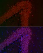 NeuN Antibody in Immunohistochemistry (Paraffin) (IHC (P))