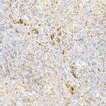 Calreticulin Antibody in Immunohistochemistry (Paraffin) (IHC (P))