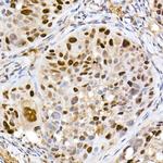 DNMT1 Antibody in Immunohistochemistry (Paraffin) (IHC (P))