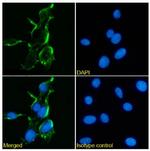 NMDAR2B Chimeric Antibody in Immunocytochemistry (ICC/IF)