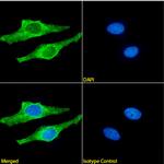 beta Amyloid (1-42) Chimeric Antibody in Immunocytochemistry (ICC/IF)