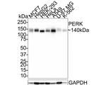 PERK Antibody in Western Blot (WB)