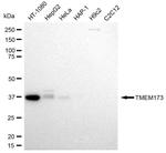 STING Antibody in Western Blot (WB)