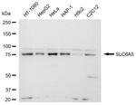 GlyT2 Antibody in Western Blot (WB)