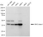 MHC Class I Antibody in Western Blot (WB)