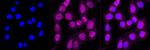 ACSL4 Antibody in Immunocytochemistry (ICC/IF)