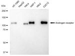 Androgen Receptor Antibody in Western Blot (WB)