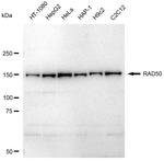 RAD50 Antibody in Western Blot (WB)