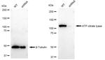 ATP Citrate Lyase Antibody