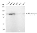 ATP Citrate Lyase Antibody in Western Blot (WB)